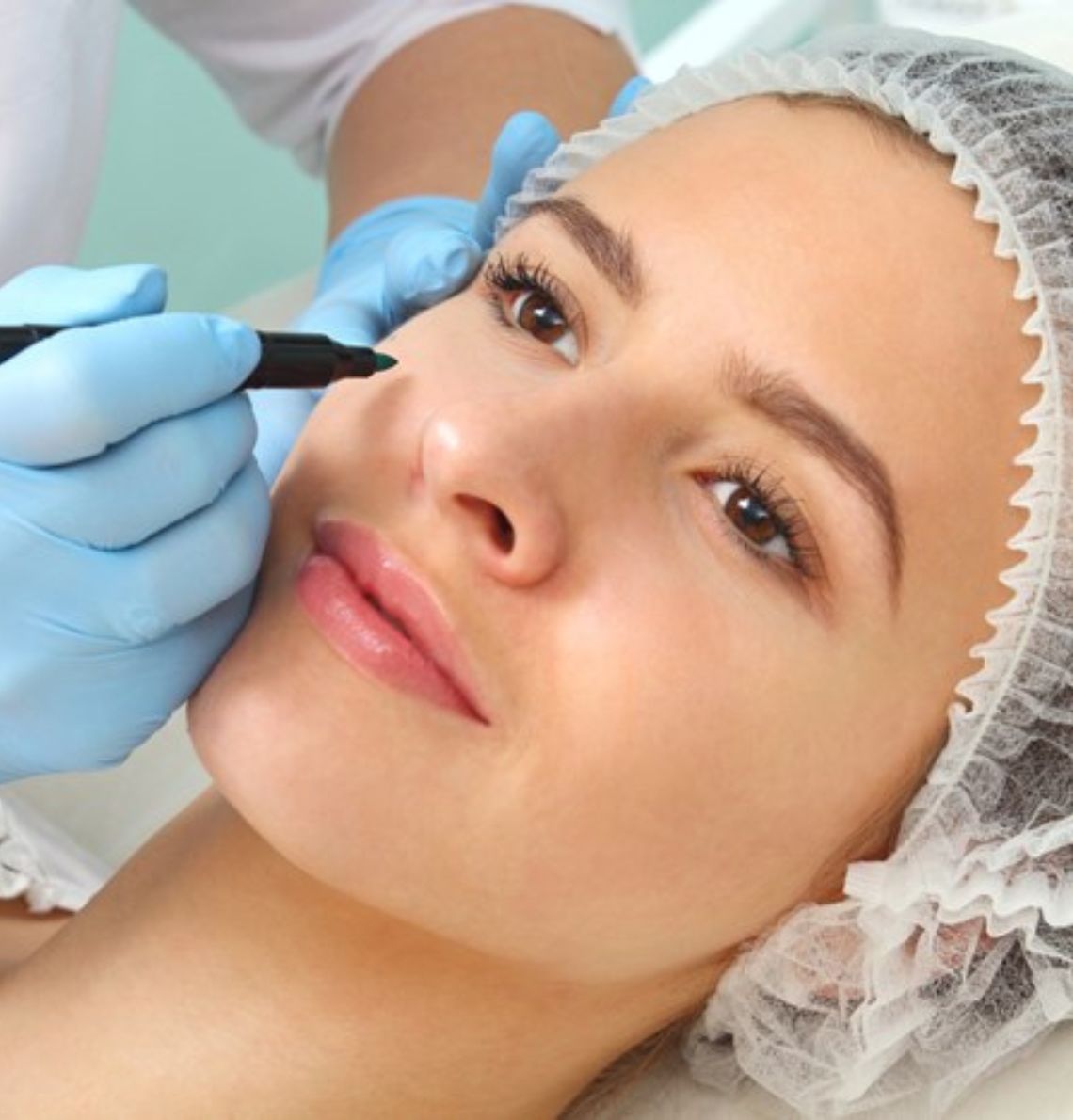 Blepharoplasty-1.jpg