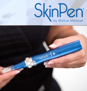 Dallas SkinPen Procedure - Clinique Dallas Medspa and Laser Center
